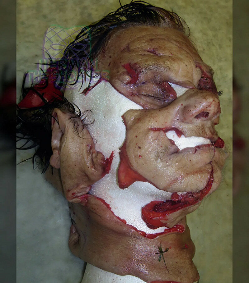 Open Casket Reconstruction