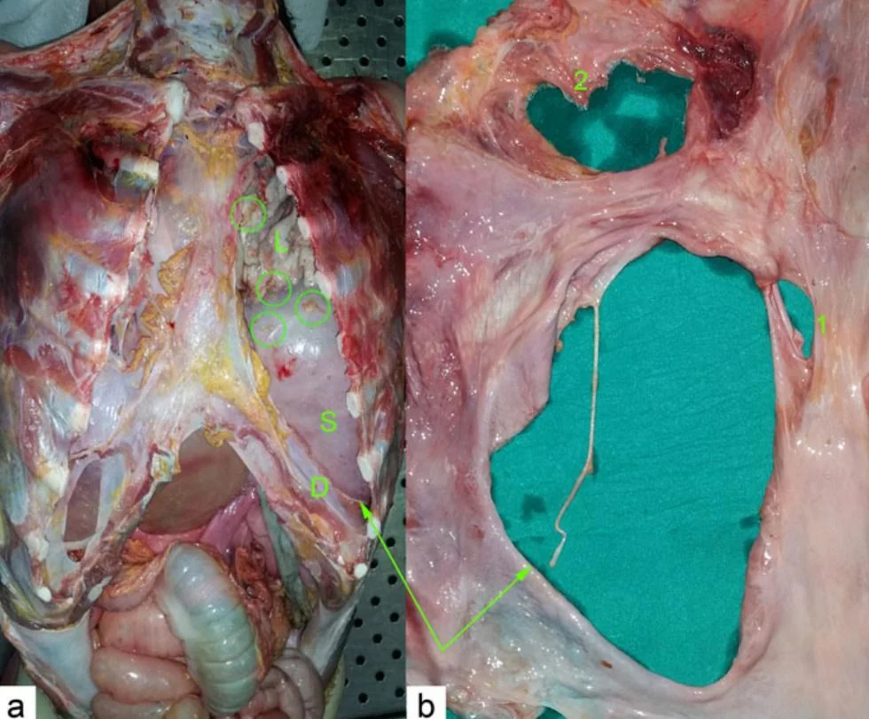 Unknown identity, 18 year old killed due to overeating.