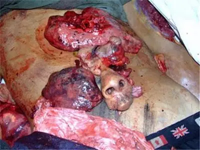 An Old Fashion Dumping