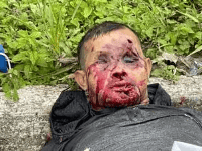 An Old Fashion Dumping