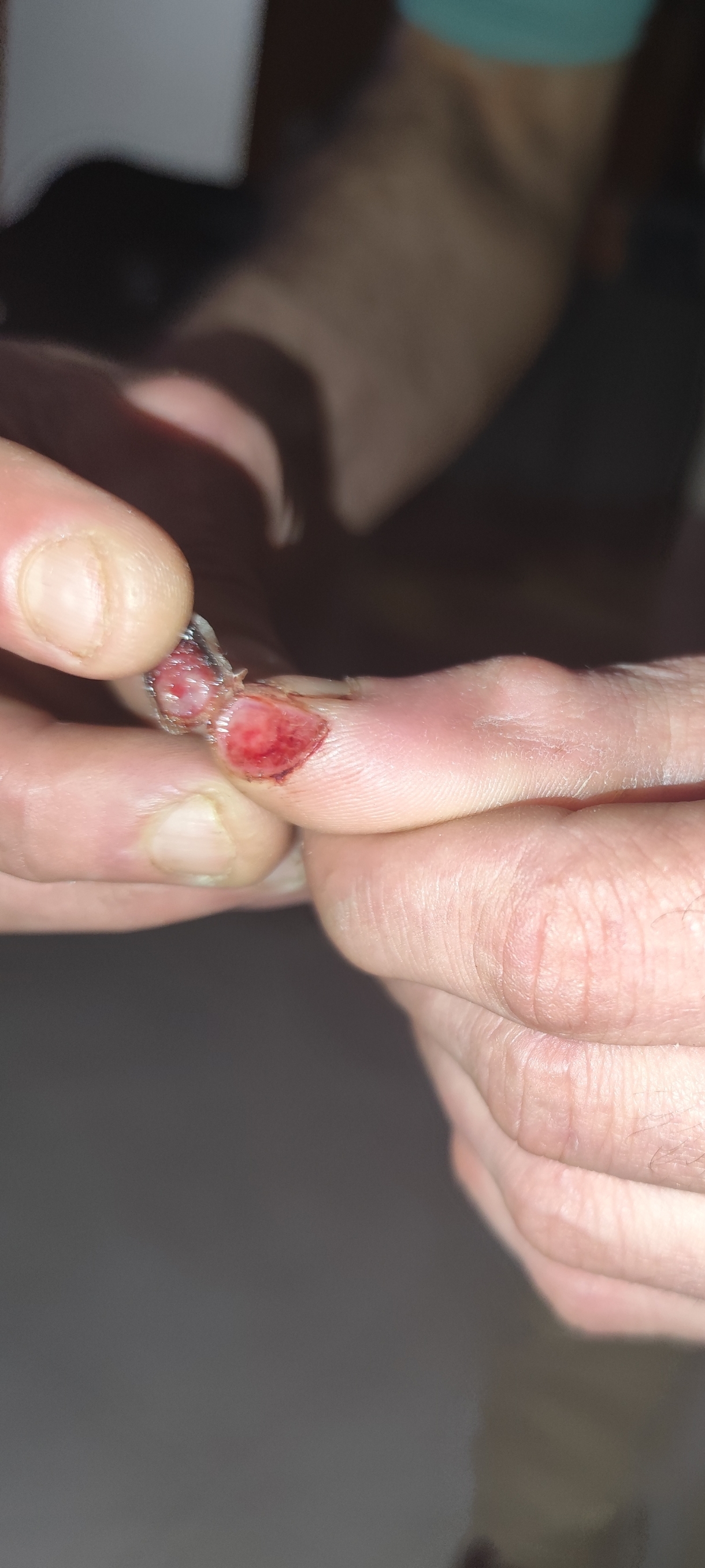 A little piece of me