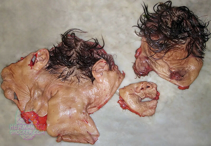 Open Casket Reconstruction