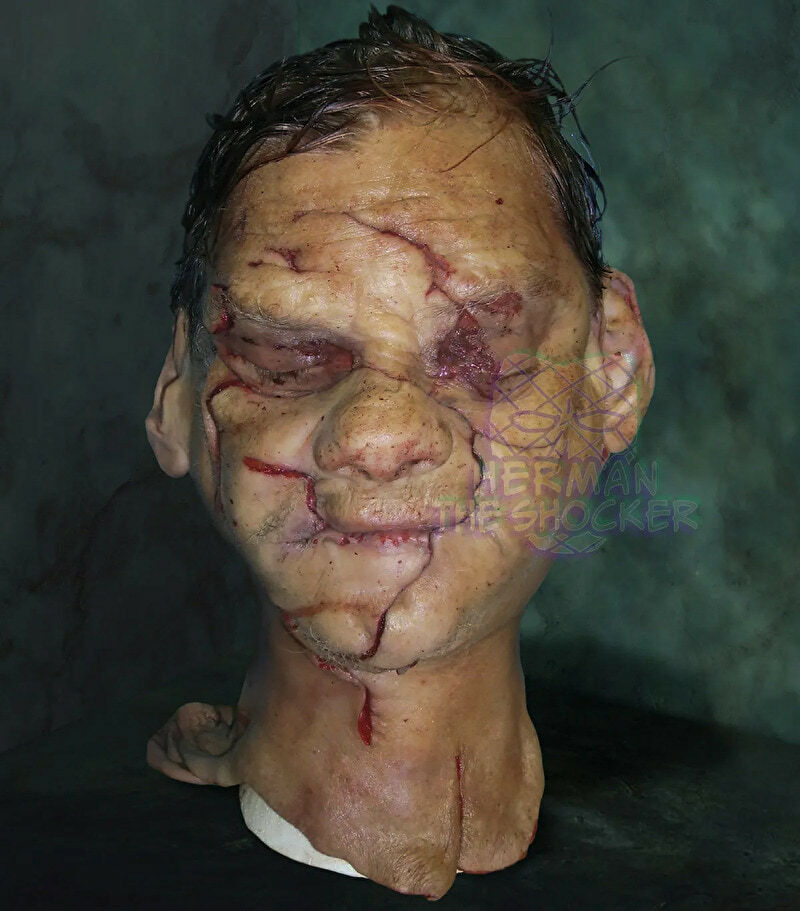 Open Casket Reconstruction