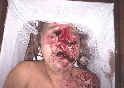 An Old Fashion Dumping