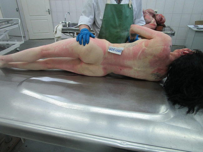 The Beautiful Autopsy