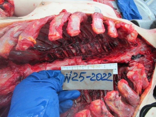 The Beautiful Autopsy
