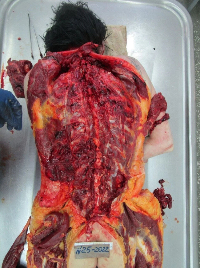 The Beautiful Autopsy