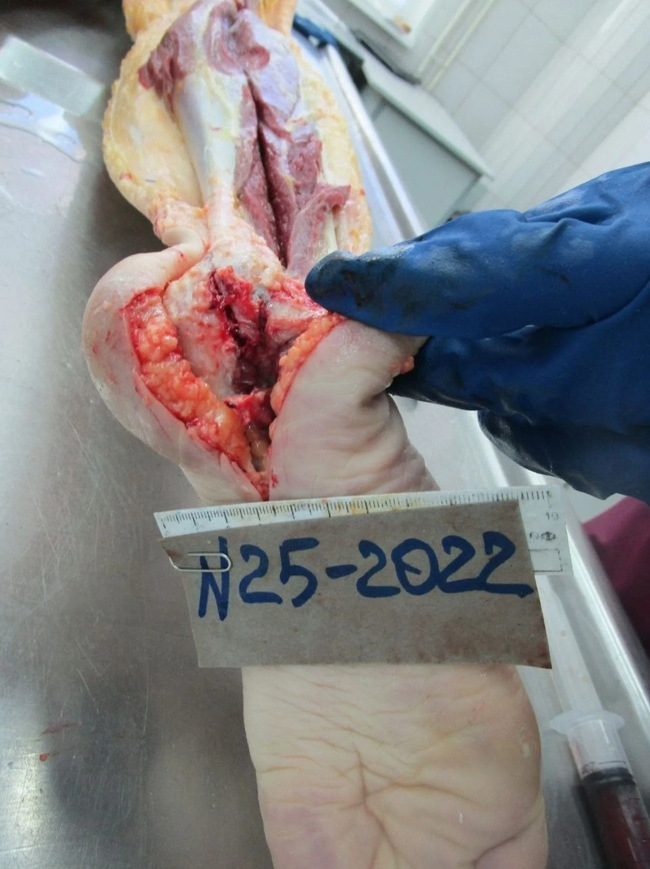 The Beautiful Autopsy