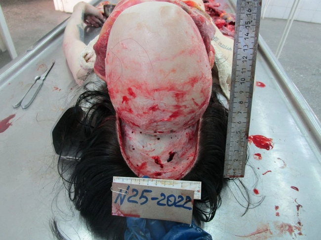 The Beautiful Autopsy