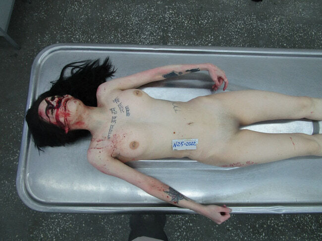The Beautiful Autopsy
