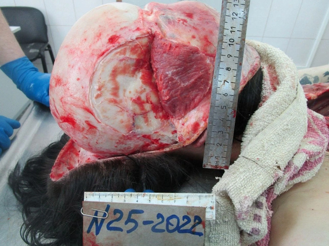 The Beautiful Autopsy
