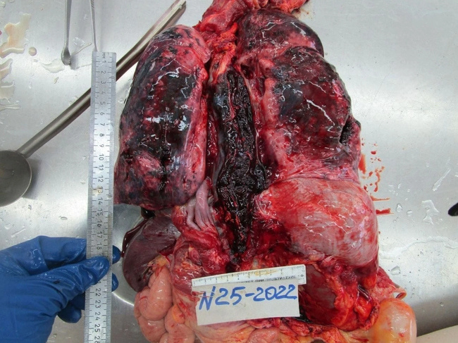 The Beautiful Autopsy