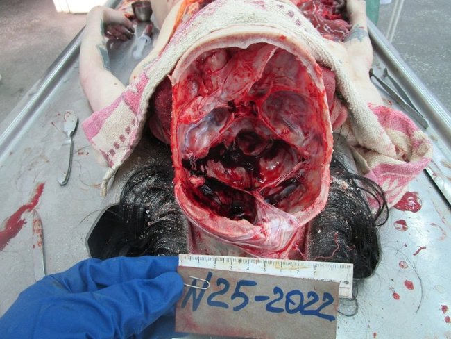 The Beautiful Autopsy
