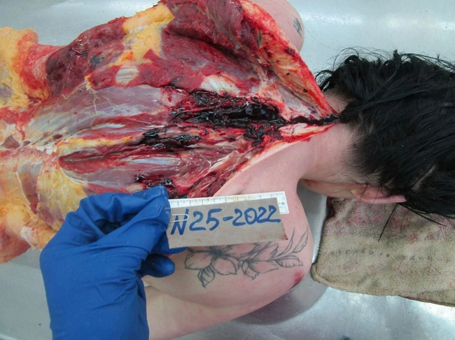 The Beautiful Autopsy