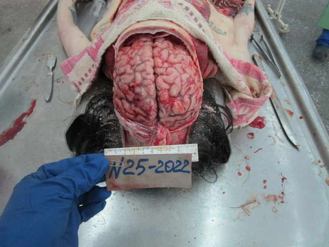 The Beautiful Autopsy