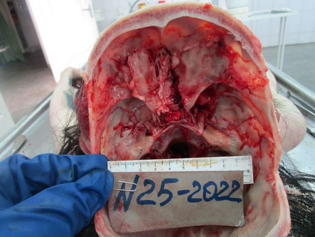 The Beautiful Autopsy