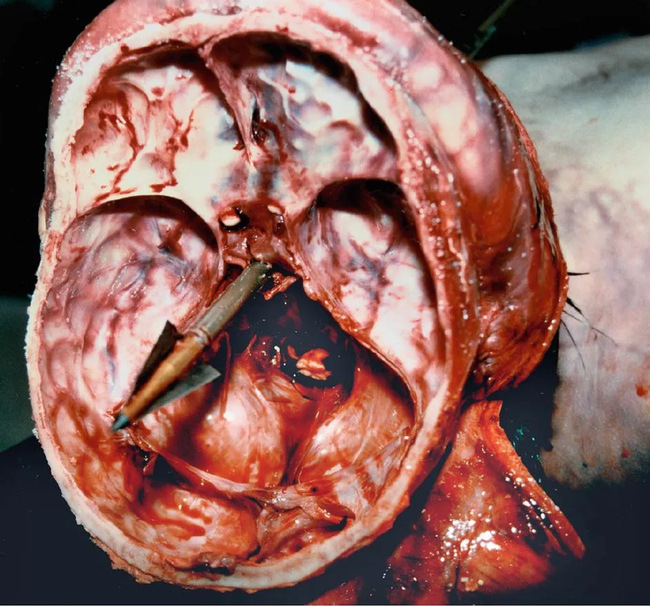 Gnarly Gallery