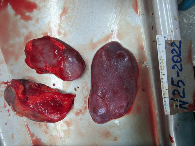 The Beautiful Autopsy