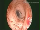 Woman has a disgusting host in her ear.