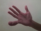 Guys Pinky Finger Swollen Up Like Popeys Arm