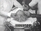 A Lobotomy Being Performed