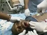 Man Has A Mobile Phone Removed From His Throat