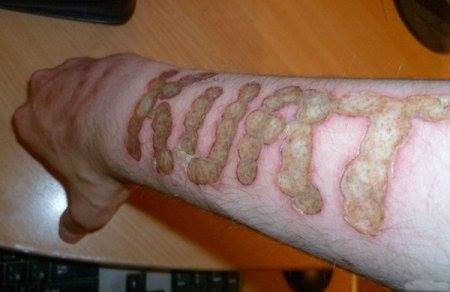 Scarification - the good and the bad