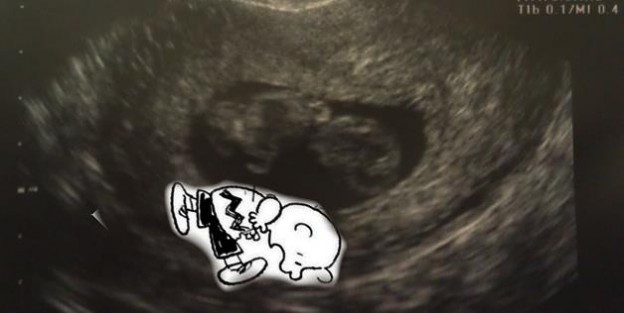 Funny Ultrasounds