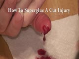 How To Superglue A Bleeding Finger Injury And Stop Bleeding