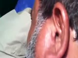 Man Has A Cockroach Removed From Ear!