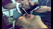 Surgeon removes a wrench from a man's throat