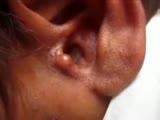 Ear Maggots!!!!!!!!!!!!!