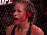 Female UFC Fighters Cauliflower Ear Explodes During The Fight