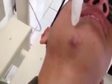 Soldier has pet botfly removed