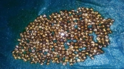 Doctors have removed a staggering 366 gallstones from a woman in India.
