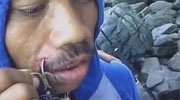 Fisherman Has A Huge Hook Stuck Through His Mouth