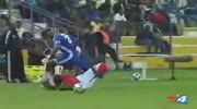 Soccer Player's Leg Breaks Like Balsa