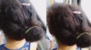 Disgusting - Womans Hair Is Full Of Fleas