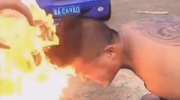 Man's Face Ignites In Flames During Idiotery Fireproof Hair Challenge