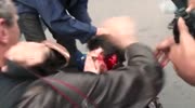 Protester Badly Injured By Grenade At Paris Protest
