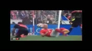 Soccer player breaks his leg