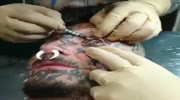 Making eye tattoo