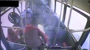 E Cig explodes in mans pocket while on bus
