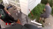 Potato Gun Misfires And Takes Out His Eye