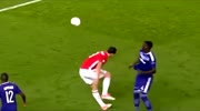 Soccer player breaks his leg
