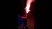 Stupid offspring loses hand shooting off fireworks..