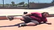 fucking fat are broken leg Skate