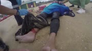 Kite boarding Crash