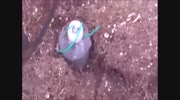 Another idiot loses hand, almost to elbow..