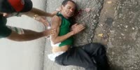 Man loses his jaw on the road